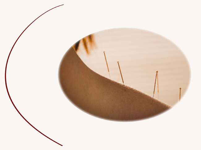 Oriental Health accupuncture